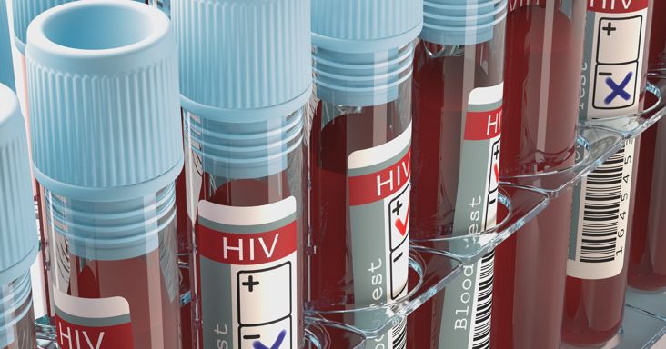 Riasztó méreteket ölt a HIV-járvány Oroszországban