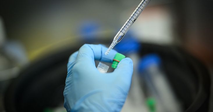 Egy mRNS-rákvakcina 42 százalékkal csökkentette a halál vagy a kiújulás kockázatát melanomás betegeknél